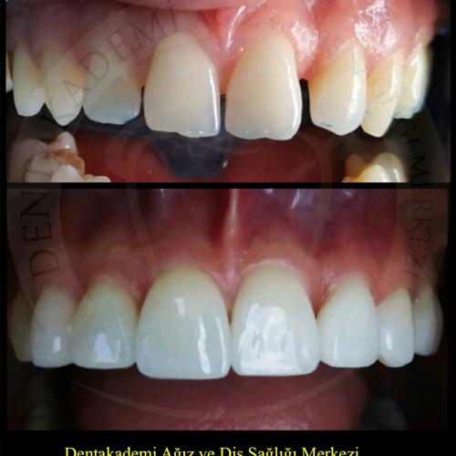 Before after photos of our patients 10